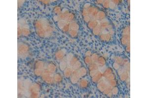 IHC-P analysis of rectum tissue, with DAB staining. (HABP2 Antikörper  (AA 24-560))