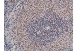 Immunohistochemistry (IHC) image for anti-LIM Domain Kinase 1 (LIMK1) (pThr508) antibody (ABIN6255701)