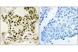 Immunohistochemistry (IHC) image for anti-Upstream Binding Transcription Factor, RNA Polymerase I (UBTF) (AA 451-500), (pSer484) antibody (ABIN1532178)