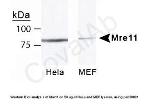 Image no. 5 for anti-MRE11 Meiotic Recombination 11 Homolog A (S. Cerevisiae) (MRE11A) antibody (ABIN363310) (Mre11 Antikörper)