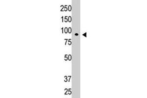 Western blot analysis of CBLC polyclonal antibody  in K-562 cell lysate. (CBLC Antikörper  (N-Term))