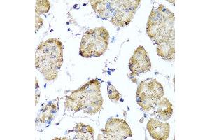 Immunohistochemistry of paraffin-embedded human gastric using STK3 antibody at dilution of 1:100 (x40 lens). (STK3 Antikörper)
