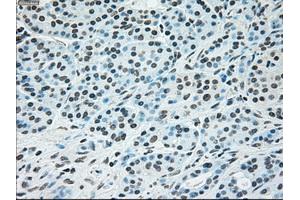 Immunohistochemical staining of paraffin-embedded Ovary tissue using anti-BRAFmouse monoclonal antibody. (BRAF Antikörper)