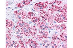 Immunohistochemistry (IHC) image for anti-ATP-Binding Cassette, Sub-Family B (MDR/TAP), Member 1 (ABCB1) (AA 863-912) antibody (ABIN6745748)