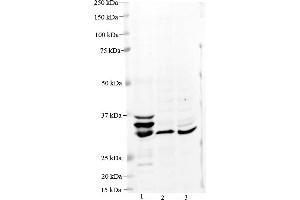 Host:  Rabbit  Target Name:  MPST  Sample Type:   Lane 1: 40 ug Human Liver lysate Lane 2: 40 ug Mouse Liver lysate Lane 3: 40 ug Rat Liver lysate  Primary Antibody Dilution:   1:1000  Secondary Antibody:    Anti-rabbit secondary antibody conjugated with Alexa Fluor 647  Secondary Antibody Dilution:   1:2500  Submitted by:   Hua Jiang, University of Colorado.