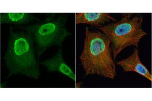 ICC/IF Image PGAM2 antibody detects PGAM2 protein at cytoplasm and nucleus by immunofluorescent analysis. (PGAM2 Antikörper)