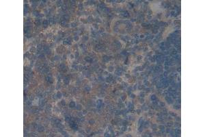 anti-Protein phosphatase 1 (AA 335-578), (Regulatory Subunit 15A) antibody
