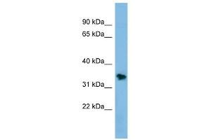 NSMCE1 antibody used at 1 ug/ml to detect target protein. (NSMCE1 Antikörper)