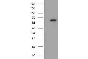 Western Blotting (WB) image for anti-Guanylate Binding Protein 5 (GBP5) antibody (ABIN1498408) (GBP5 Antikörper)