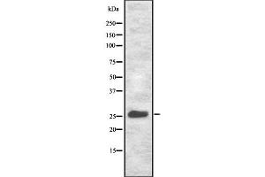 Western blot analysis NET-5 using HeLa whole cell lysates (Tetraspanin 9 Antikörper  (Internal Region))