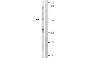 Western blot analysis of extracts from CV-1 cells treated with forsklin. (LKB1 Antikörper)