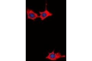 Immunofluorescent analysis of GRB10 staining in HepG2 cells. (GRB10 Antikörper  (N-Term))