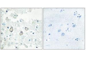 Immunohistochemistry analysis of paraffin-embedded human brain tissue using DOK7 antibody. (DOK7 Antikörper  (N-Term))