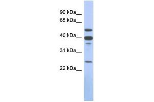WB Suggested Anti-MMP13 Antibody Titration: 0. (MMP13 Antikörper  (Middle Region))