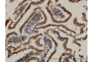 Image no. 3 for anti-Cell Death-Inducing DFFA-Like Effector B (CIDEB) (AA 3-111) antibody (ABIN599215) (CIDEB Antikörper  (AA 3-111))