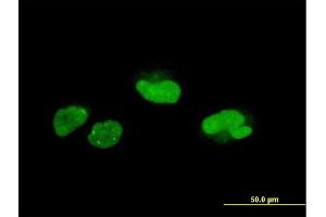 Immunofluorescence of monoclonal antibody to SCAND1 on HeLa cell. (SCAND1 Antikörper  (AA 1-179))
