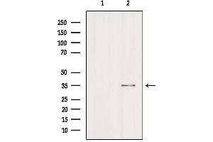 Western blot analysis of extracts from Hela, using FCGR2A Antibody. (FCGR2A Antikörper  (C-Term))