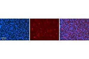 Rabbit Anti-MLX Antibody   Formalin Fixed Paraffin Embedded Tissue: Human Liver Tissue Observed Staining: Cytoplasm in speckles in hepatocytes Primary Antibody Concentration: 1:100 Other Working Concentrations: 1:600 Secondary Antibody: Donkey anti-Rabbit-Cy3 Secondary Antibody Concentration: 1:200 Magnification: 20X Exposure Time: 0. (MLX Antikörper  (C-Term))