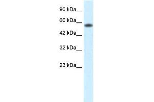 Human Jurkat; WB Suggested Anti-PCYOX1 Antibody Titration: 0. (PCYOX1 Antikörper  (C-Term))