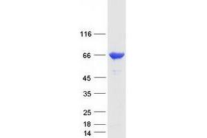 Western Blotting (WB) image for G Protein-Coupled Receptor Kinase 6 (GRK6) (Transcript Variant 1) protein (Myc-DYKDDDDK Tag) (ABIN2722254)