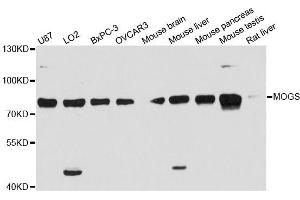 Western blot analysis of extracts of various cell lines, using MOGS antibody (ABIN6292972) at 1:3000 dilution. (GCS1 Antikörper)