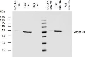 Western blotting analysis of human vimentin using mouse monoclonal antibody VI-10 on lysates of MOLT-4 cell line (low expression), U87 cell line (positive) and Raji cell line (negative control) under non-reducing and reducing conditions. (Vimentin Antikörper)