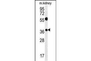 Tetraspanin 3 Antikörper  (AA 90-117)