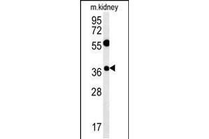 Western blot analysis in mouse kidney tissue lysates (15ug/lane). (Tetraspanin 3 Antikörper  (AA 90-117))