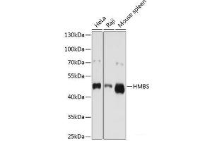 Western blot analysis of extracts of various cell lines using HMBS Polyclonal Antibody at dilution of 1:1000. (HMBS Antikörper)