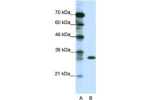 WB Suggested Anti-TSFM Antibody Titration:  1. (TSFM Antikörper  (C-Term))