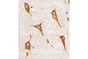 (ABIN6243055 and ABIN6577107) staining B in human brain sections by Immunohistochemistry (IHC-P - paraformaldehyde-fixed, paraffin-embedded sections). (BCAP31 Antikörper  (AA 1-246))