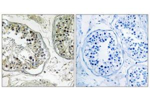 Immunohistochemistry analysis of paraffin-embedded human testis tissue, using CHST13 antibody. (CHST13 Antikörper  (Internal Region))