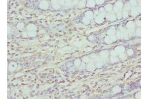 Immunohistochemistry of paraffin-embedded human colon tissue using ABIN7147359 at dilution of 1:100 (CP110 Antikörper  (AA 1-280))
