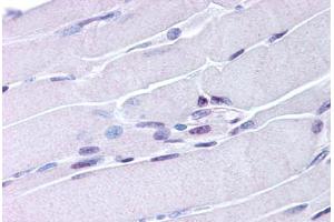 Immunohistochemistry (IHC) image for anti-Nuclear Receptor Subfamily 4, Group A, Member 1 (NR4A1) (AA 251-266) antibody (ABIN213736)