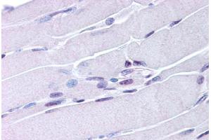 Skeletal Muscle (NR4A1 Antikörper  (AA 251-266))