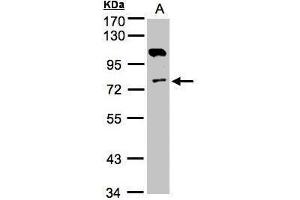WB Image Sample(30 ug whole cell lysate) A:A431, 7. (Adenylate Kinase 7 Antikörper)
