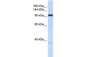 WB Suggested Anti-OGT Antibody Titration: 0. (OGT Antikörper  (N-Term))