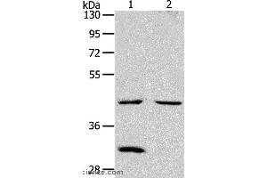 Western blot analysis of Mouse kidney and heart tissue, using NCEH1 Polyclonal Antibody at dilution of 1:1300