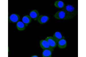 SH-SY-5Y cells were fixed in paraformaldehyde, permeabilized with 0. (EIF4E Antikörper  (pSer209))