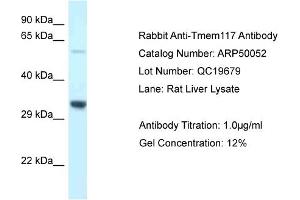 WB Suggested Anti-Tmem117 Antibody   Titration: 1. (TMEM117 Antikörper  (C-Term))
