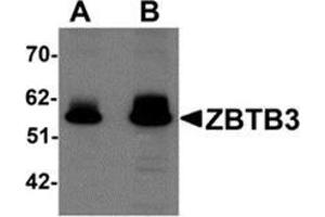 Western blot analysis of ZBTB3 in rat brain tissue lysate with ZBTB3 antibody at (A) 1 and (B) 2 μg/ml.