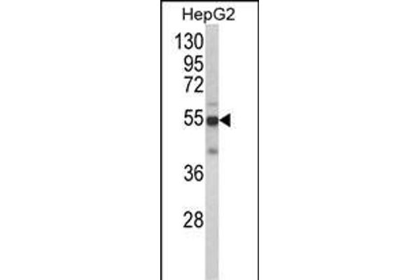 CYP2J2 Antikörper  (N-Term)