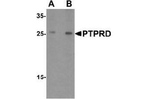 Western blot analysis of PTPRD in HeLa cell lysate with PTPRD Antibody  at (A) 1 and (B) 2 ug/mL. (PTPRD Antikörper  (N-Term))