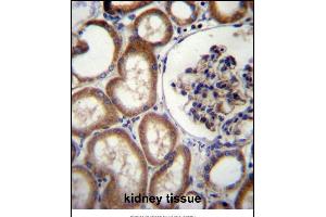 Immunohistochemistry (Paraffin-embedded Sections) (IHC (p)) image for anti-Membrane-Bound Transcription Factor Peptidase, Site 2 (MBTPS2) (AA 15-44), (N-Term) antibody (ABIN656896)