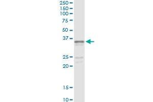 Immunoprecipitation of SGCG transfected lysate using anti-SGCG monoclonal antibody and Protein A Magnetic Bead , and immunoblotted with SGCG MaxPab rabbit polyclonal antibody. (SGCG Antikörper  (AA 191-290))