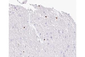 ABIN6267006 at 1/100 staining human Brain tissue sections by IHC-P. (MOK Antikörper  (Internal Region))