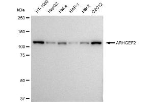 Western blotting analysis using ARHGEF2 antibody (ABIN7800207). (Rekombinanter ARHGEF2 Antikörper)