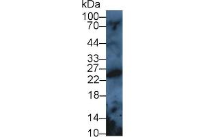 Detection of PRDX3 in Rat Serum using Polyclonal Antibody to Peroxiredoxin 3 (PRDX3) (Peroxiredoxin 3 Antikörper  (AA 5-233))
