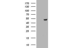 Image no. 2 for anti-Thymidine Phosphorylase (TYMP) (AA 311-482) antibody (ABIN1491400) (Thymidine Phosphorylase Antikörper  (AA 311-482))