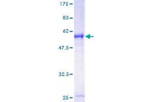 Immediate Early Response 2 (IER2) (AA 1-223) protein (GST tag)